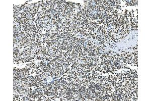 IHC analysis of Glycine decarboxylase/GLDC using anti-Glycine decarboxylase/GLDC antibody (ABIN7602073). (GLDC anticorps  (AA 574-1020))