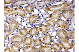 TCP1 theta was detected in paraffin-embedded sections of mouse kidney tissues using rabbit anti- TCP1 theta Antigen Affinity purified polyclonal antibody (Catalog # ) at 1 µg/mL.