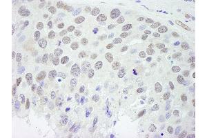 Immunohistochemistry (IHC) image for anti-RNA Binding Motif Protein 9 (RBM9) (AA 1-50) antibody (ABIN7448568)