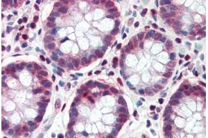 anti-Transcription Factor 7-Like 1 (T-Cell Specific, HMG-Box) (TCF7L1) (AA 35-84) antibody