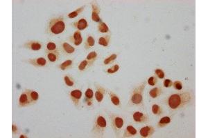 Immunocytochemistry analysis of ABIN7139592 diluted at 1:10 and staining in Hela cells performed on a Leica BondTM system.