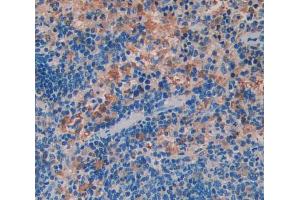 Used in DAB staining on fromalin fixed paraffin- embedded Kidney tissue (WASP anticorps  (AA 39-251))