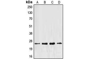 Western blot analysis of EEF1B2 expression in Jurkat (A), HeLa (B), MCF7 (C), A431 (D) whole cell lysates. (EEF1B2 anticorps  (Center))