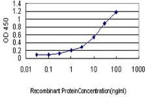 Detection limit for recombinant GST tagged CAMK1 is approximately 0. (CAMK1 anticorps  (AA 271-370))