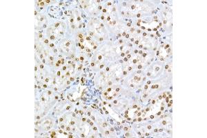 Immunohistochemistry of paraffin-embedded rat kidney using Phospho-RB-S795 Rabbit pAb (ABIN3023606, ABIN3023607, ABIN3023608 and ABIN6225464) at dilution of 1:50 (40x lens). (Retinoblastoma 1 anticorps  (pSer795))