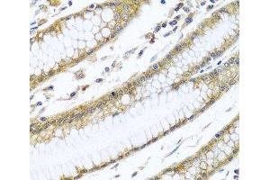 Immunohistochemistry of paraffin-embedded Human stomach using GNAI3 Polyclonal Antibody at dilution of 1:100 (40x lens). (GNAI3 anticorps)