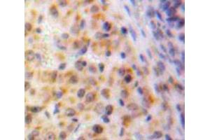 IHC-P analysis of Ovary tissue, with DAB staining. (EGR1 anticorps  (AA 282-433))
