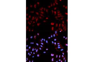 Immunofluorescence (IF) image for anti-Histone Cluster 1, H3b (HIST1H3B) (pSer29) antibody (ABIN1870230) (Histone H3.1 anticorps  (pSer29))