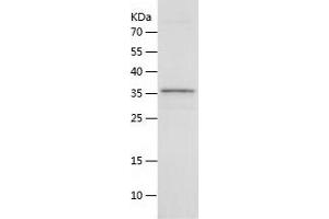 Western Blotting (WB) image for Interleukin 21 (IL21) (AA 25-155) protein (His-IF2DI Tag) (ABIN7123570) (IL-21 Protein (AA 25-155) (His-IF2DI Tag))
