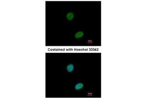 ICC/IF Image Immunofluorescence analysis of paraformaldehyde-fixed HeLa, using Ataxin 3, antibody at 1:500 dilution. (Ataxin 3 anticorps)