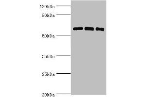 Western blot All lanes: PRKAA2 antibody at 8 μg/mL Lane 1: Hela whole cell lysate Lane 2: K562 whole cell lysate Lane 3: MCF-7 whole cell lysate Secondary Goat polyclonal to rabbit IgG at 1/10000 dilution Predicted band size: 62 kDa Observed band size: 62 kDa