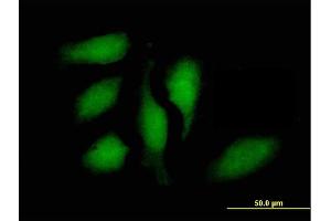 Immunofluorescence of purified MaxPab antibody to STAT1 on HeLa cell. (STAT1 anticorps  (AA 1-712))