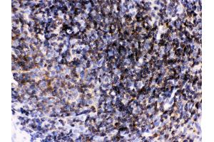 Anti- Lck Picoband antibody, IHC(P) IHC(P): Rat Lymphaden Tissue