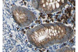 ABIN6267024 at 1/100 staining human Appendix tissue sections by IHC-P. (SDC4 anticorps  (C-Term))