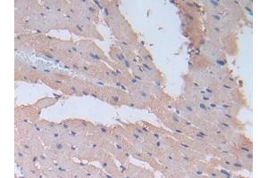 Detection of FN in Rat Heart Tissue using Polyclonal Antibody to Fibronectin (FN)