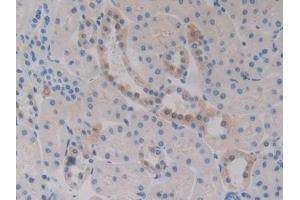DAB staining on IHC-P; Samples: Rat Kidney Tissue (FCAR anticorps  (AA 51-280))