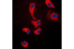 Immunofluorescent analysis of MYD88 staining in Jurkat cells. (MYD88 anticorps  (Center))