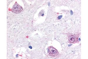 Anti-ROR Beta antibody IHC of human brain, thalamus. (RORB anticorps  (Hinge Region))