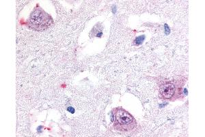 Anti-ROR Beta antibody IHC of human brain, thalamus. (RORB anticorps  (Hinge Region))