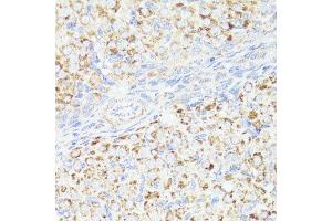 Immunohistochemistry of paraffin-embedded rat ovary using ErbB2 antibody.