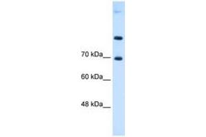 Image no. 1 for anti-Solute Carrier Family 7 (Cationic Amino Acid Transporter, Y+ System), Member 4 (SLC7A4) (AA 281-330) antibody (ABIN6736656) (SLC7A4 anticorps  (AA 281-330))
