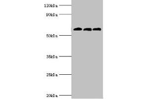 Western blot All lanes: 4-aminobutyrate aminotransferase, mitochondrial antibody at 10 μg/mL Lane 1: Rat liver tissue Lane 2: Mouse pancreatic tissue Lane 3: Mouse kidney tissue Secondary Goat polyclonal to rabbit IgG at 1/10000 dilution Predicted band size: 56 kDa Observed band size: 56 kDa (ABAT anticorps  (AA 29-300))