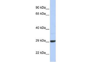 C10ORF56 antibody used at 1 ug/ml to detect target protein. (ZCCHC24 anticorps  (Middle Region))