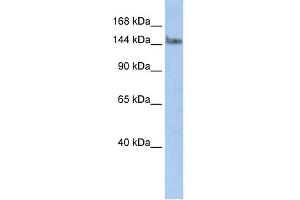 WB Suggested Anti-TCERG1 Antibody Titration:  0. (TCERG1 anticorps  (N-Term))