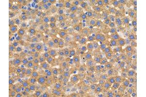 ABIN6258253 and ABIN6274256 at 1/100 staining Rat liver tissue by IHC-P.