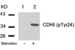 Image no. 2 for anti-Cyclin-Dependent Kinase 6 (CDK6) (pTyr24) antibody (ABIN319289) (CDK6 anticorps  (pTyr24))