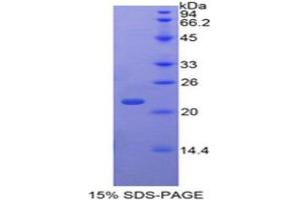 SDS-PAGE (SDS) image for TAF12 RNA Polymerase II, TATA Box Binding Protein (TBP)-Associated Factor, 20kDa (TAF12) (AA 1-161) protein (His tag) (ABIN1879709)
