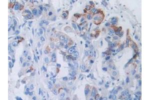 Used in DAB staining on fromalin fixed paraffin- embedded kidney tissue (SLC12A3 anticorps  (AA 3-146))