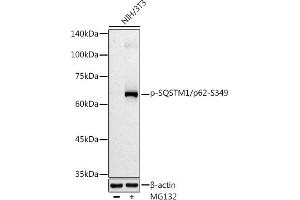 Western blot analysis of extracts of NIH/3T3 cells, using Phospho-SQSTM1/p62-S349 antibody (ABIN7270206) at 1:500 dilution.
