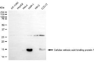 Western blotting analysis using cellular retinoic acid binding protein 1 antibody (ABIN7798021).