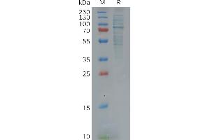 Human Protein, His Tag on SDS-PAGE under reducing condition.