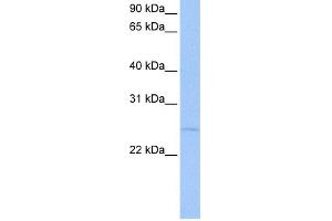 WB Suggested Anti-CTA-126B4. (CTA-126B4.3 (N-Term) anticorps)
