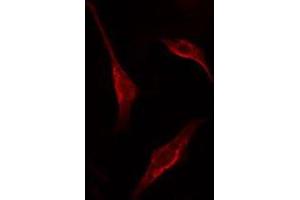 ABIN6275361 staining HT29 cells by IF/ICC. (PNN anticorps  (Internal Region))