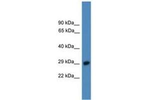 Image no. 1 for anti-Proteasome (Prosome, Macropain) 26S Subunit, Non-ATPase, 9 (PSMD9) (C-Term) antibody (ABIN6745293) (PSMD9 anticorps  (C-Term))