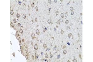Immunohistochemistry of paraffin-embedded Mouse brain using HBA2 Polyclonal Antibody at dilution of 1:100 (40x lens). (HBa2 anticorps)