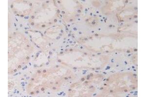 IHC-P analysis of Human Kidney Tissue, with DAB staining. (BIRC2 anticorps  (AA 1-497))