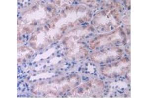 IHC-P analysis of Human Kidney Tissue, with DAB staining. (IL-2 anticorps  (AA 21-153))