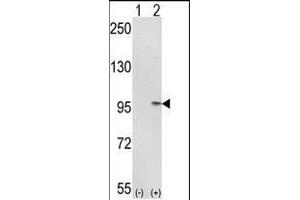 Western blot analysis of IT (arrow) using rabbit polyclonal IT Antibody (C-term) (ABIN389476 and ABIN2839538).