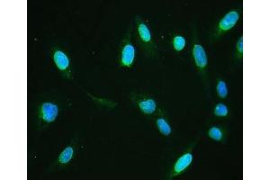 IF analysis of Emerin using anti-Emerin antibody (ABIN4886569). (Emerin anticorps  (N-Term))