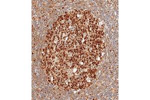 Immunohistochemical analysis of paraffin-embedded human tonsil tissue using (ABIN1882267 and ABIN2838476) performed on the Leica® BOND RXm. (MSH2 anticorps)