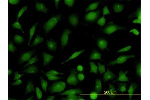 Immunofluorescence of monoclonal antibody to RAB21 on HeLa cell.