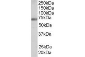Western Blotting (WB) image for anti-Formin Binding Protein 1 (FNBP1) (Internal Region) antibody (ABIN2465683) (FNBP1 anticorps  (Internal Region))