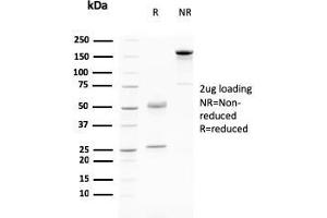 SDS-PAGE Analysis Purified Desmoglein-3 Mouse Monoclonal Antibody (DSG3/2796). (Desmoglein 3 anticorps  (AA 379-491))