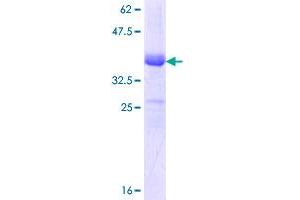 Image no. 1 for Solute Carrier Family 12 (Potassium-Chloride Transporter) Member 2 (SLC12A2) (AA 903-1010) protein (GST tag) (ABIN1320129)