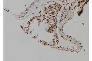 ABIN6263166 and ABIN6276979 at 1/100 staining Rat lung tissue by IHC-P. (MCM6 anticorps  (C-Term))