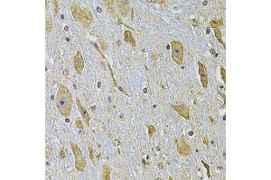 Immunohistochemistry of paraffin-embedded mouse brain using ITGA2 Antibody. (ITGA2 anticorps)